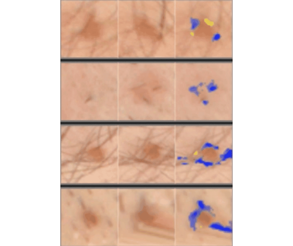 AI change detection